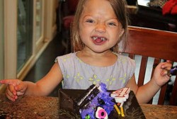 Lahir dengan Tulang Rapuh, Bocah Ini Bisa Bertahan Hidup Berkat Eksperimen