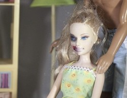 Boneka Barbie Disiksa Seniman, Mata Lebam Sampai Bibir Berdarah