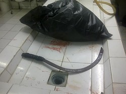 Mengerikan! Pelajar Bogor Tewas Saat Tawuran dengan Celurit Menancap di Kepala