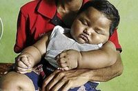 Si Raksasa Kyairiel, Balita 13 Bulan yang Beratnya Seperti Bocah 5 Tahun