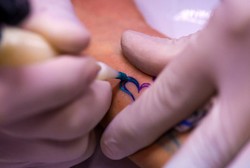 Bikin Tato Penis di Punggung Penyandang Disabilitas, Pria Ini Dipenjara