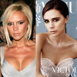 Victoria Beckham Ngaku Pernah Operasi Plastik Besarkan Payudara