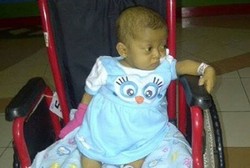 Perjuangan Aqila, Bayi 1 Tahun Melawan Penyakit Atresia Bilier