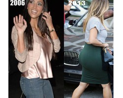 Kim Kardashian Melakukan Pembesaran Bokong, Ini Foto Perbedaannya