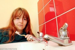 Alergi Air, Rachel Selalu Kesakitan Tiap Mandi dan Minum