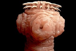 Gunakan Cacing Hingga Urine, Ini 6 Pengobatan Medis Teraneh