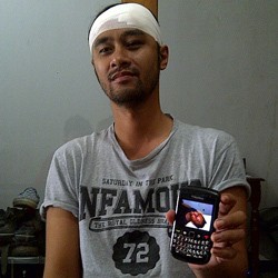 Ini Penjelasan Polisi Soal Insiden Pemukulan Iyo Pure Saturday