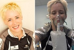 Alergi Terhadap 23 Pemicu, Karen Hampir Meninggal 80 Kali