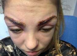 Hiii...Alis Remaja Ini Jadi Bernanah Setelah Diwarnai