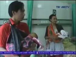Bayi Kembar Terkena Penyakit Langka yang Menyerang Alat Vital