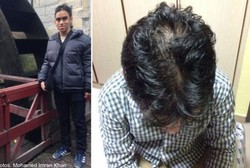 Kebotakan Dini, Baru Umur 12 Tahun Tapi Rambut Imran Sudah Mulai Rontok