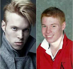 Jadi Korban Bullying Saat Kecil, Si Culun Ini Kini Top Model