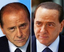Silvio Berlusconi: Skandal Seks dan Permak Wajah