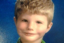 Derita Sindrom Langka, Bocah Ini Akhirnya Bisa Tertawa Usai Operasi