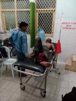 2 Pekerja SPBU di Tanjungpinang Terbakar Saat Bersihkan Tangki