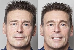 Pengalaman Pria yang Waxing Alis, Sakit Tapi Ketagihan