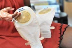 Miss V Robek Parah Saat Melahirkan, Seorang Wanita Harus BAB Lewat Vagina