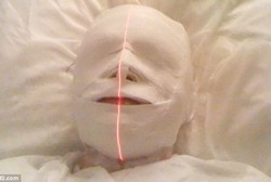 Tumor Otak 2 Kali Gagal Ditemukan, Remaja Ini Jadi Mumi Saat Diterapi