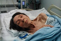 Kena Penyakit Misterius, Wanita Ini Mendadak Kurus Kering dalam 3 Bulan