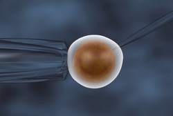 Ini Dia Tahapan Prosedur Bayi Tabung