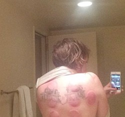 Masuk Angin, Lena Dunham Pamer Foto Selfie Pasca Dibekam