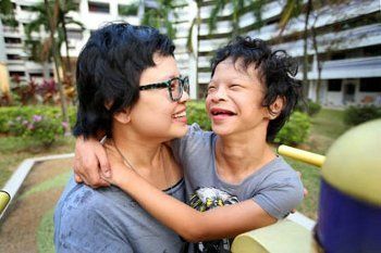 Ella, Bocah yang Terlalu Ramah Akibat Sindrom William