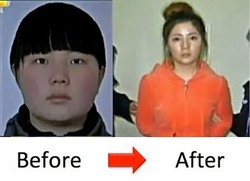 Gara-gara Operasi Plastik, Wanita Muda Ini Malah Masuk Penjara