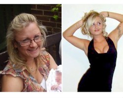 Wanita Ini Terobsesi Operasi Plastik Hingga Habiskan Biaya Rp 470 Juta