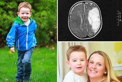 Terlahir dengan Separuh Otak, Bocah Ini Buktikan Bisa Hidup Normal
