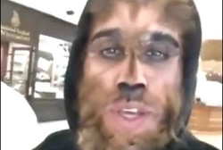 Tak Dihormati Sebagai Manusia, Pria Kuwait Operasi Wajah Mirip Serigala