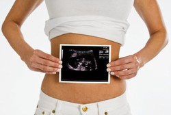 Sulit Punya Anak? Cek ke Dokter, Bisa Jadi Buluh Rahim Terserang Kuman TB