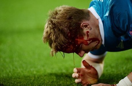 Darah yang Mengucur di Liga Champions