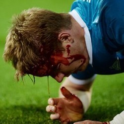 Darah yang Mengucur di Liga Champions