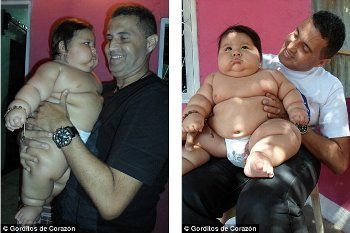 Santiago Mendoza, Bayi Umur 8 Bulan Tapi Bobotnya Sama dengan Anak 6 Tahun