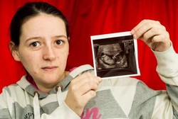 Janinnya Hanya Punya Peluang Hidup 1% karena Tumor, Wanita Ini Tak Menyerah