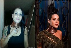 Ingin Jadi Wanita Jerapah, Sydney Pasang Cincin Sepanjang 29 cm di Leher