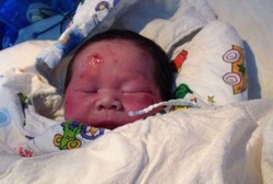 Ajaib! Bayi Ini Selamat Usai Terpental Sejauh 3 M Saat Ibu Ditabrak Truk