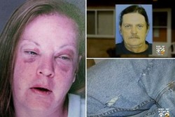 Cekcok Masalah Rumah Tangga, Wanita Ini Hampir Potong Alat Kelamin Suami