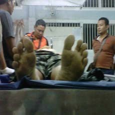 Tertembak di Pantat, Pelaku Perampokan Nasabah Bank Tewas