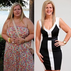 Hipnotis dan Tas Branded, Rahasia Sukses Laura Turunkan 51 Kg Berat Badan