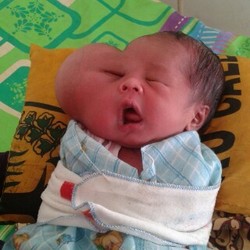 Tolong Bayi dengan Dua Wajah ini dari Keluarga Miskin Tak Punya Biaya Operasi