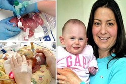 Bayi yang Berbobot 0,45 Kg Saat Lahir Ini Tampak Sehat di Ultah Pertamanya