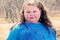 Usai Operasi Tumor Otak, Bocah Ini Malah Didera Lapar Setiap Saat