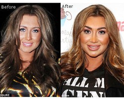 Bintang Reality TV Ini Wajahnya Mirip Tupai Setelah Dikabarkan Suntik Botoks