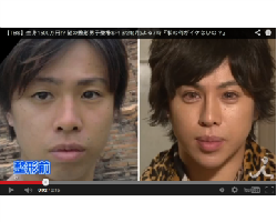 Ini Perubahan Wajah Pria yang Habiskan Rp 1,6 M untuk Operasi Plastik