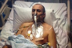 Sakit Langka, Kerongkongan Pria Ini Digerogoti Bakteri Pemakan Daging