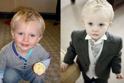 Keliru Diagnosis, Bocah Ini Meninggal Sia-sia Karena Infeksi Langka