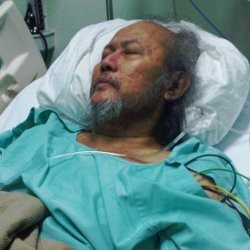 Pepeng Ingin Dirawat di Rumah Agar Keluarga Tak Sedih