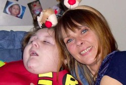 Sakit Otak Langka, Bocah Ini Ucapkan Kata Pertama di Usia 9 Tahun