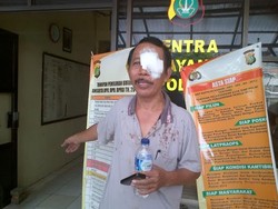 Melerai Pemotor yang Berkelahi di Jalan di Cipinang, Suharto Malah Kena Bogem